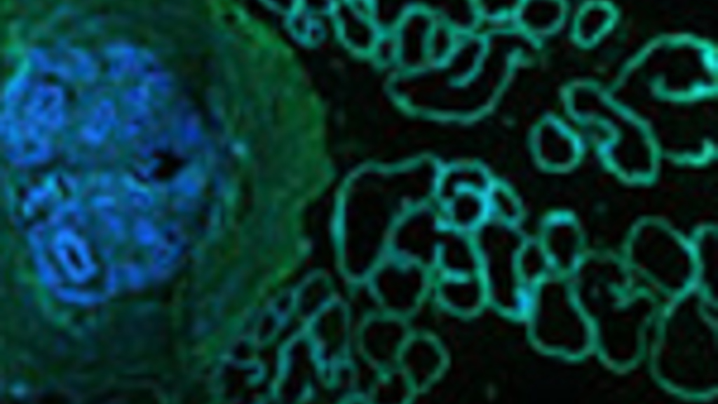 cancer_biology