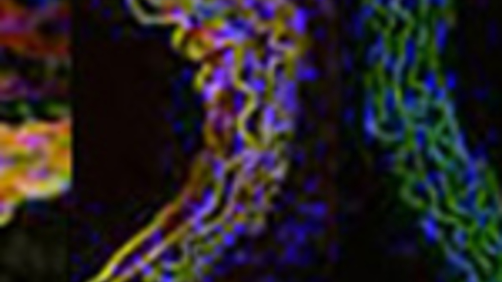 Structure and Function of Membrane Ion Channels and Transporters